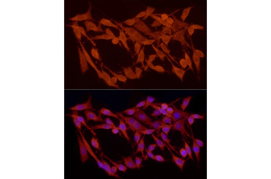 Immunofluorescence - Anti-Smad 2 + Smad3 Antibody (A15769) - Antibodies.com