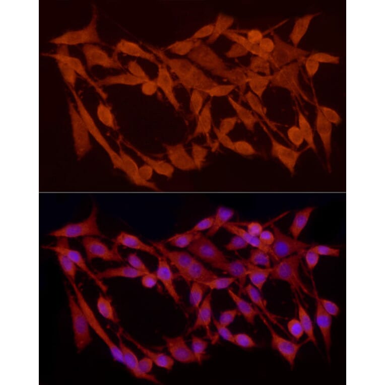 Immunofluorescence - Anti-Smad 2 + Smad3 Antibody (A15769) - Antibodies.com