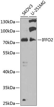Western blot analysis of extracts of various cell lines, using Anti-IFFO2 Antibody (A7541) at 1:1,000 dilution.
Secondary antibody: Goat Anti-Rabbit IgG (H+L) (HRP) (AS014) at 1:10,000 dilution.
Lysates / proteins: 25µg per lane.
Blocking buffer: 3% non-fat dry milk in TBST.
Detection: ECL Basic Kit (RM00020).
Exposure time: 90s.