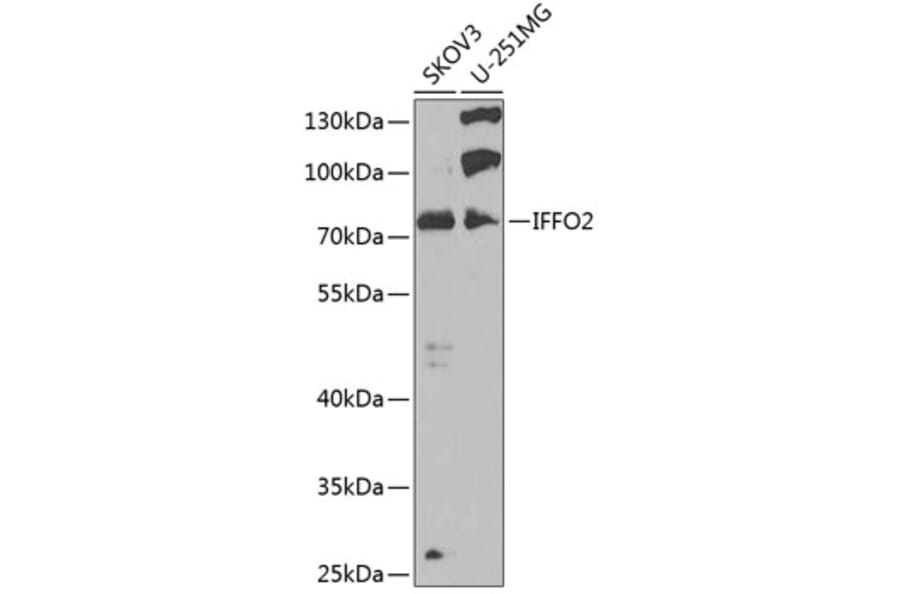 Western Blot - Anti-IFFO2 Antibody (A15771) - Antibodies.com