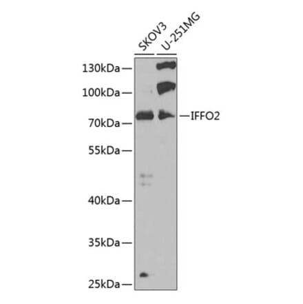 Western Blot - Anti-IFFO2 Antibody (A15771) - Antibodies.com