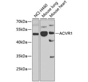 Western Blot - Anti-Activin Receptor Type IA Antibody (A15772) - Antibodies.com