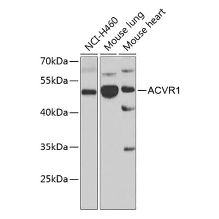 Western Blot - Anti-Activin Receptor Type IA Antibody (A15772) - Antibodies.com