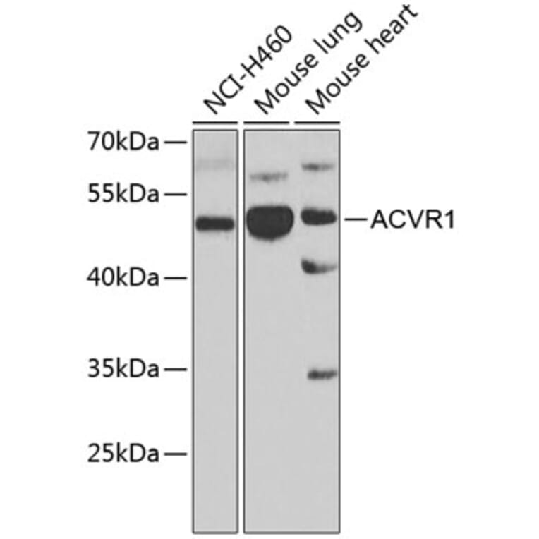 Western Blot - Anti-Activin Receptor Type IA Antibody (A15772) - Antibodies.com