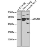 Western Blot - Anti-Activin Receptor Type IA Antibody (A15772) - Antibodies.com