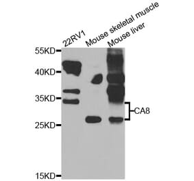 Western Blot - Anti-CA8 Antibody (A7544) - Antibodies.com