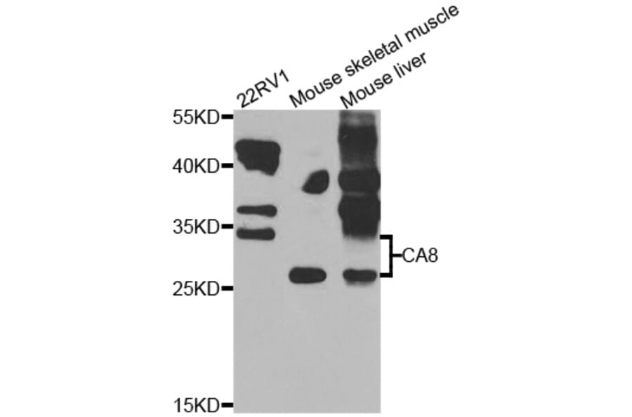 Western Blot - Anti-CA8 Antibody (A7544) - Antibodies.com