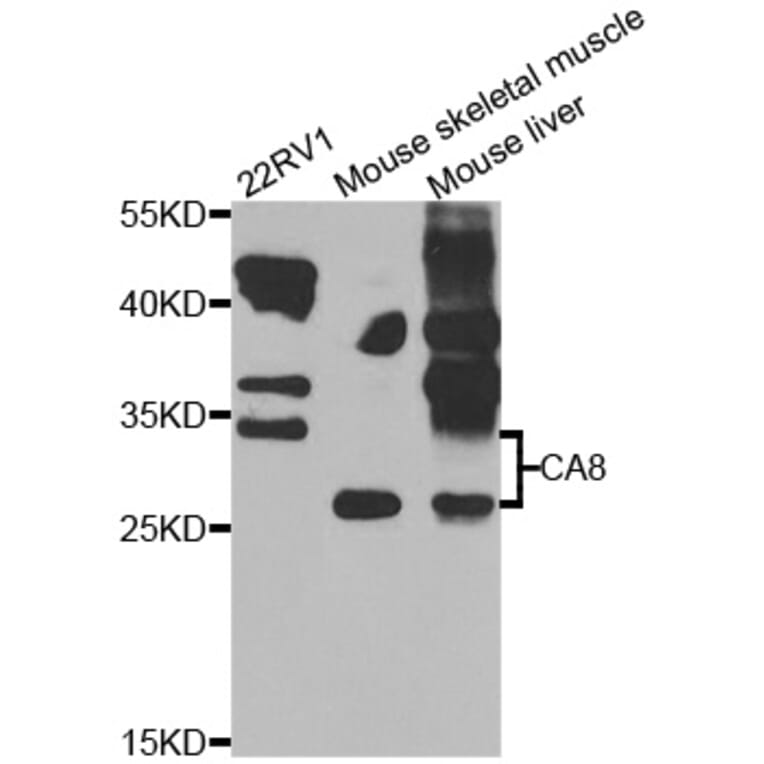 Western Blot - Anti-CA8 Antibody (A7544) - Antibodies.com