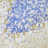 Immunohistochemistry - Anti-CA8 Antibody (A7544) - Antibodies.com