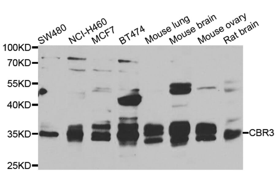 Western Blot - Anti-CBR3 Antibody (A7545) - Antibodies.com