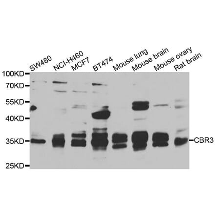 Western Blot - Anti-CBR3 Antibody (A7545) - Antibodies.com