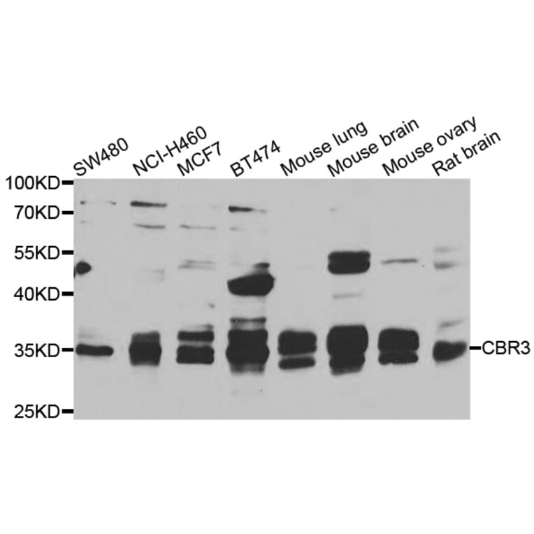 Western Blot - Anti-CBR3 Antibody (A7545) - Antibodies.com