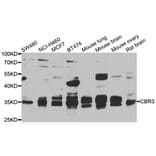 Western Blot - Anti-CBR3 Antibody (A7545) - Antibodies.com