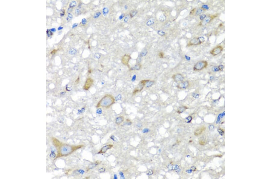 Immunohistochemistry - Anti-CBR3 Antibody (A7545) - Antibodies.com