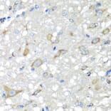 Immunohistochemistry - Anti-CBR3 Antibody (A7545) - Antibodies.com