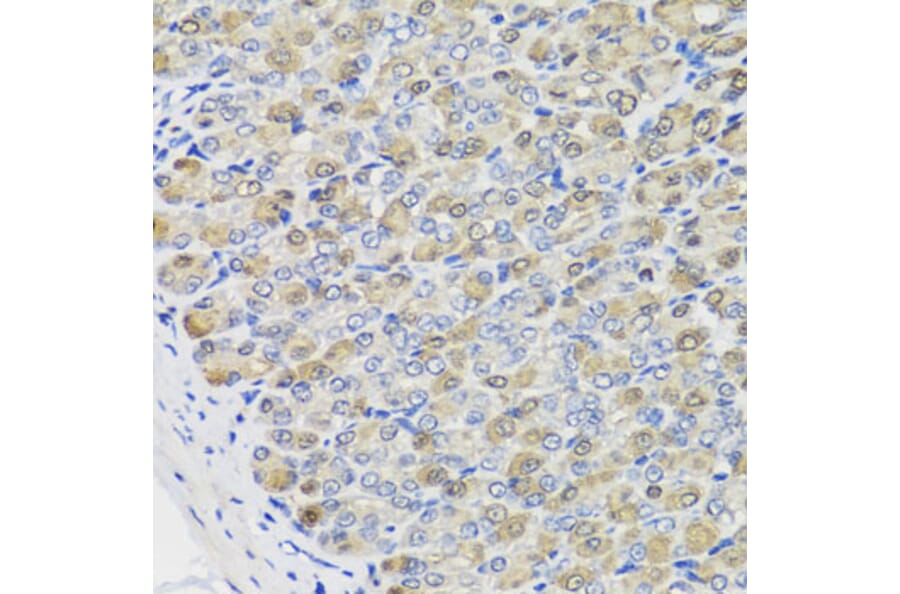Immunohistochemistry - Anti-CBR3 Antibody (A7545) - Antibodies.com