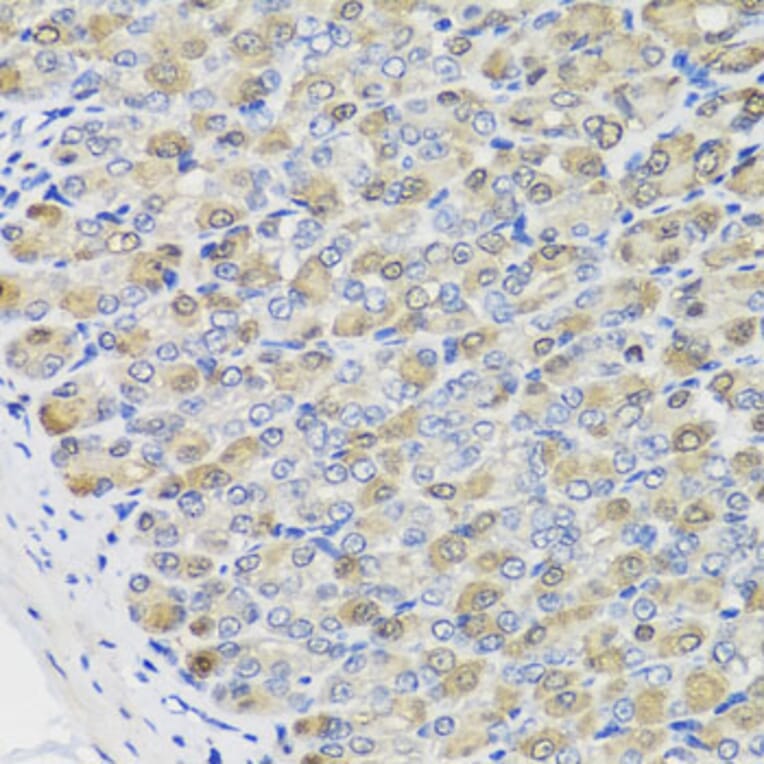 Immunohistochemistry - Anti-CBR3 Antibody (A7545) - Antibodies.com