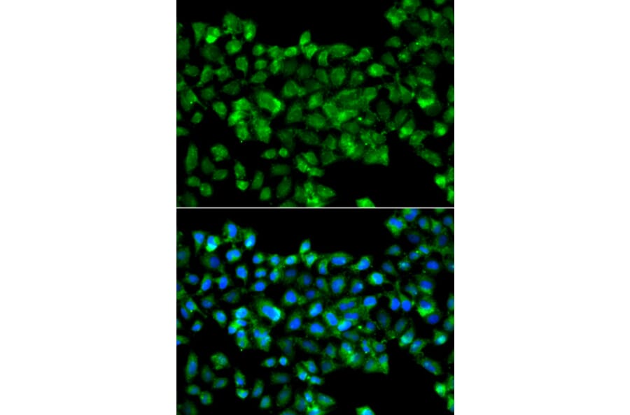 Immunofluorescence - Anti-CBR3 Antibody (A7545) - Antibodies.com