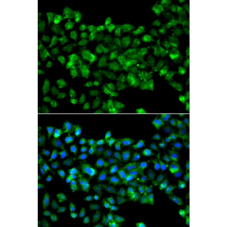 Immunofluorescence - Anti-CBR3 Antibody (A7545) - Antibodies.com