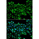 Immunofluorescence - Anti-CBR3 Antibody (A7545) - Antibodies.com