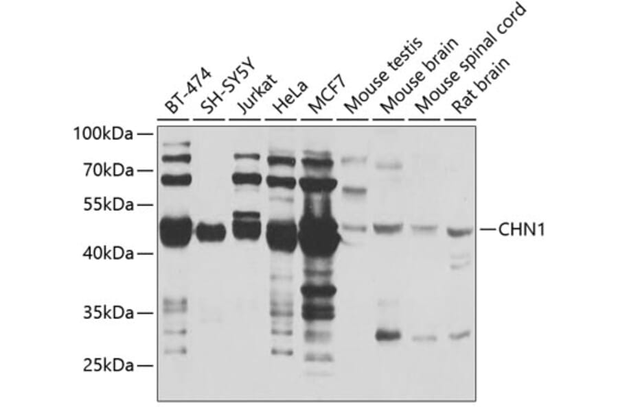Western Blot - Anti-CHN1 Antibody (A7546) - Antibodies.com