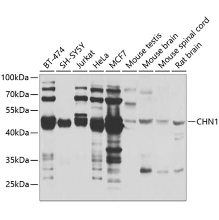 Western Blot - Anti-CHN1 Antibody (A7546) - Antibodies.com