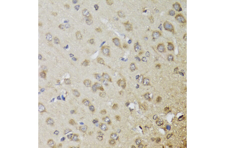 Immunohistochemistry - Anti-CHN1 Antibody (A7546) - Antibodies.com
