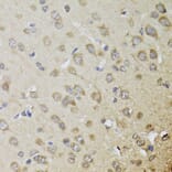 Immunohistochemistry - Anti-CHN1 Antibody (A7546) - Antibodies.com