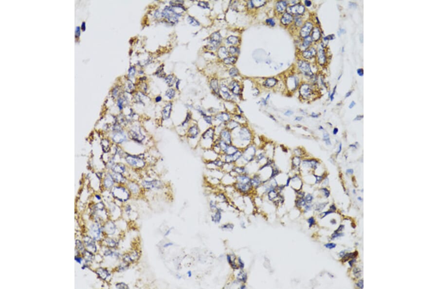 Immunohistochemistry - Anti-CHN1 Antibody (A7546) - Antibodies.com