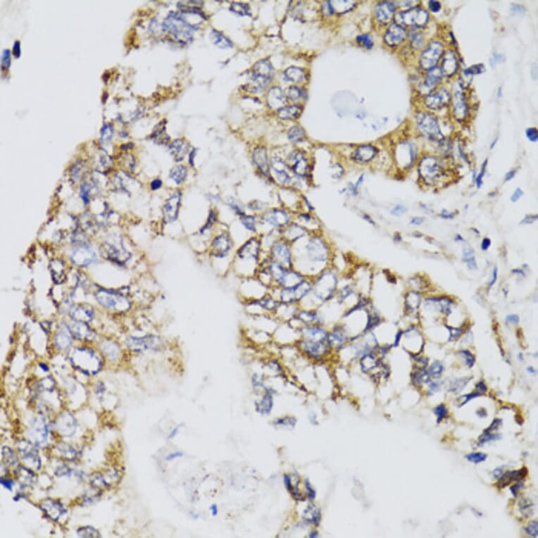 Immunohistochemistry - Anti-CHN1 Antibody (A7546) - Antibodies.com