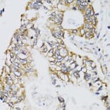 Immunohistochemistry - Anti-CHN1 Antibody (A7546) - Antibodies.com