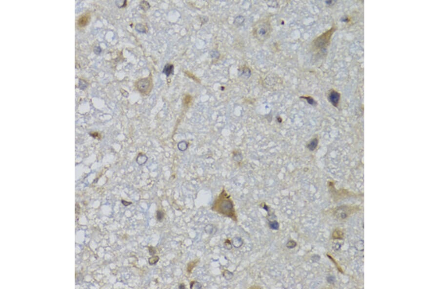 Immunohistochemistry - Anti-CHN1 Antibody (A7546) - Antibodies.com
