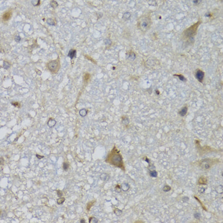 Immunohistochemistry - Anti-CHN1 Antibody (A7546) - Antibodies.com