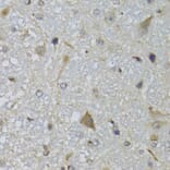 Immunohistochemistry - Anti-CHN1 Antibody (A7546) - Antibodies.com