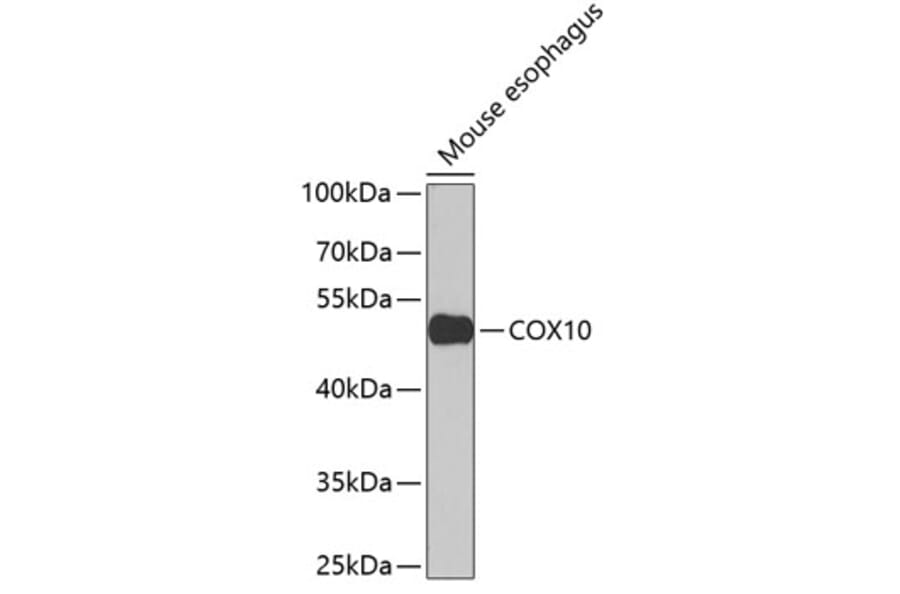 Western Blot - Anti-COX10 Antibody (A15776) - Antibodies.com