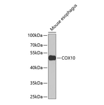 Western Blot - Anti-COX10 Antibody (A15776) - Antibodies.com
