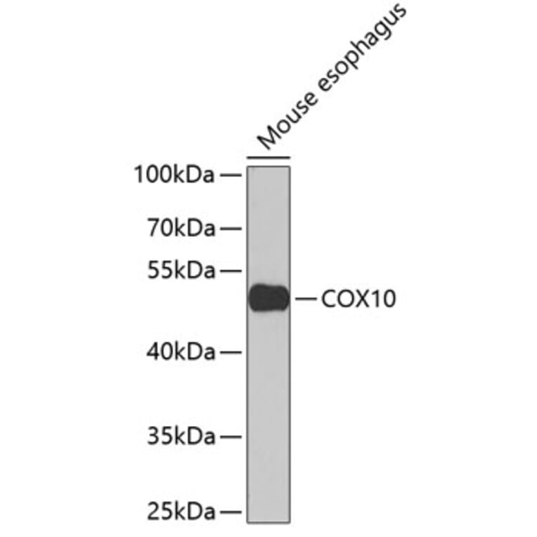Western Blot - Anti-COX10 Antibody (A15776) - Antibodies.com