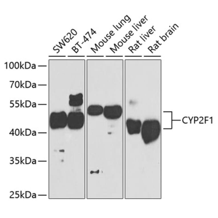 Western Blot - Anti-CYP2F1 Antibody (A15777) - Antibodies.com