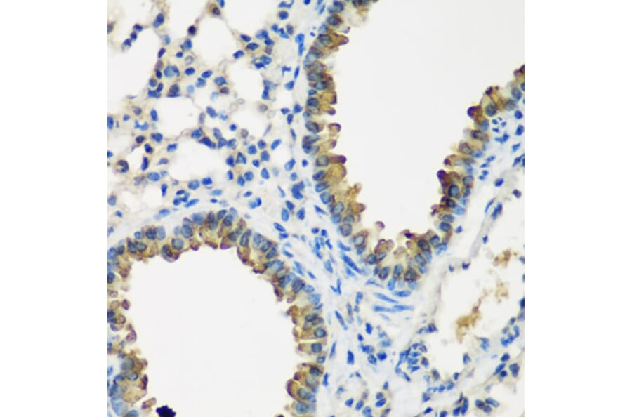Immunohistochemistry - Anti-CYP2F1 Antibody (A15777) - Antibodies.com