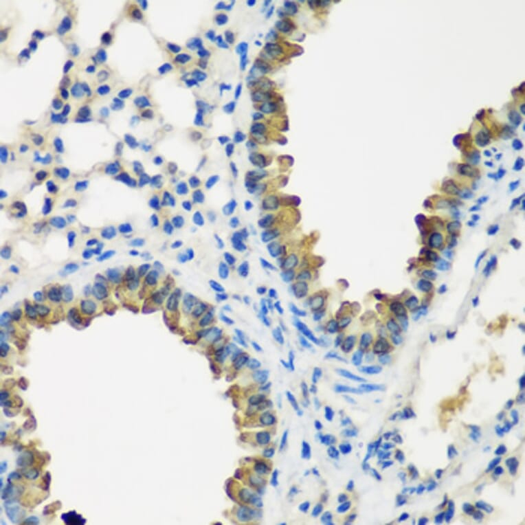 Immunohistochemistry - Anti-CYP2F1 Antibody (A15777) - Antibodies.com