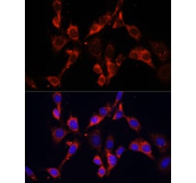 Immunofluorescence - Anti-Dishevelled 2 Antibody (A15778) - Antibodies.com