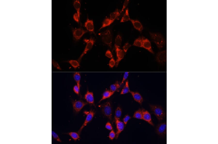 Immunofluorescence - Anti-Dishevelled 2 Antibody (A15778) - Antibodies.com