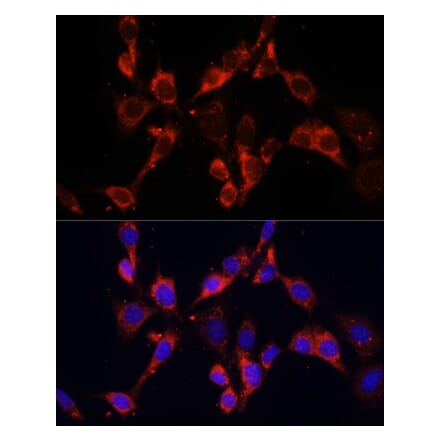 Immunofluorescence - Anti-Dishevelled 2 Antibody (A15778) - Antibodies.com