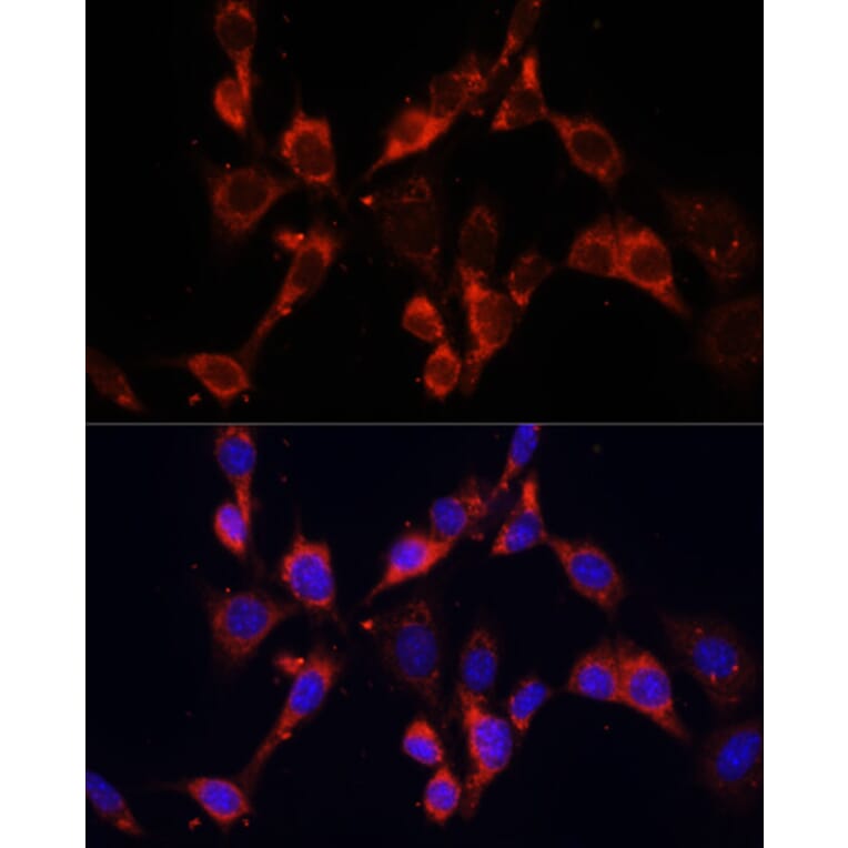 Immunofluorescence - Anti-Dishevelled 2 Antibody (A15778) - Antibodies.com