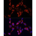 Immunofluorescence - Anti-Dishevelled 2 Antibody (A15778) - Antibodies.com