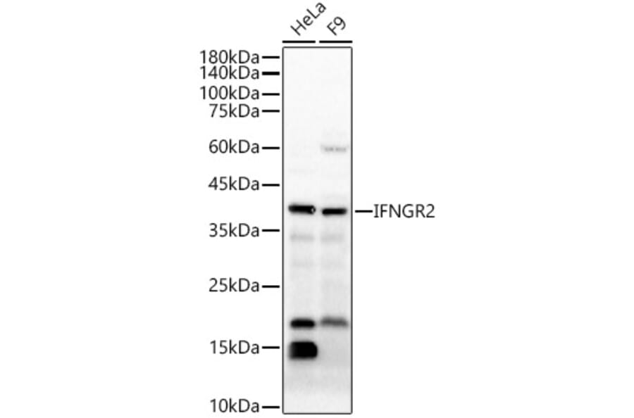 Western Blot - Anti-IFN gamma Receptor beta/AF-1 Antibody (A15779) - Antibodies.com