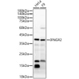 Western Blot - Anti-IFN gamma Receptor beta/AF-1 Antibody (A15779) - Antibodies.com