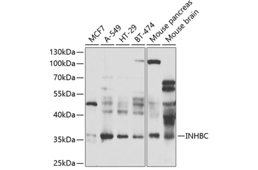 Western Blot - Anti-INHBC Antibody (A15780) - Antibodies.com