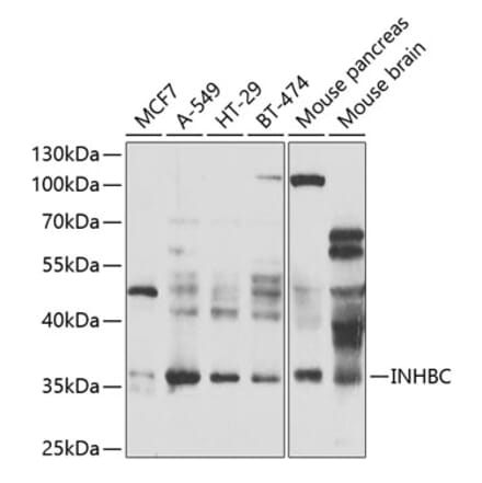 Western Blot - Anti-INHBC Antibody (A15780) - Antibodies.com