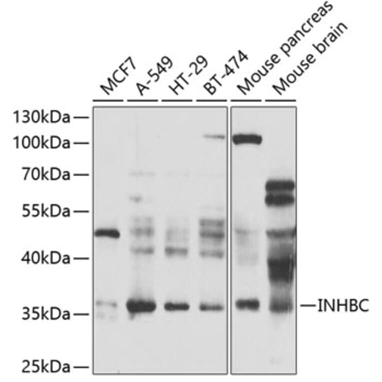 Western Blot - Anti-INHBC Antibody (A15780) - Antibodies.com